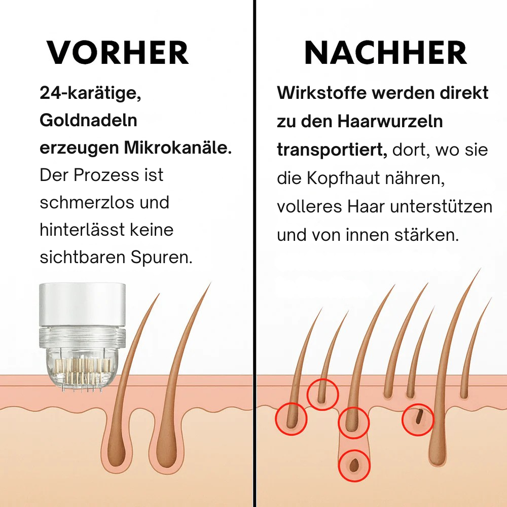 Glow Drops™ Mikronadel Pflege System